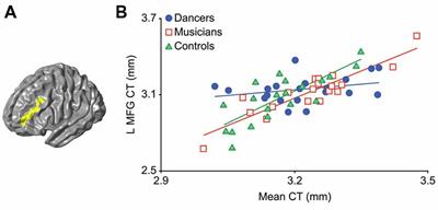 Structural Covariance Analysis Reveals Differences Between Dancers and Untrained Controls